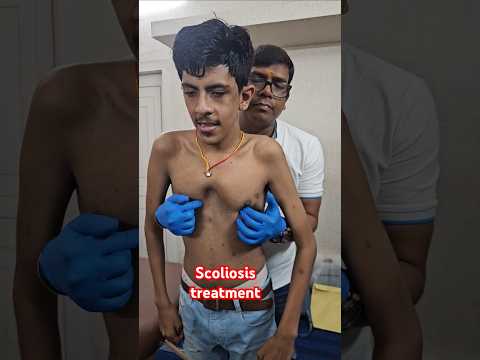 Scoliosis treatment #drrajneeshkant #worldfamouschiropractor