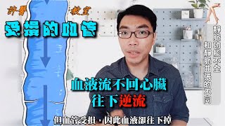 什麼是靜脈功能不全？和靜脈曲張有什麼不同？｜許原彰醫師：台中，高雄，台南，台北，新竹，靜脈曲張專家