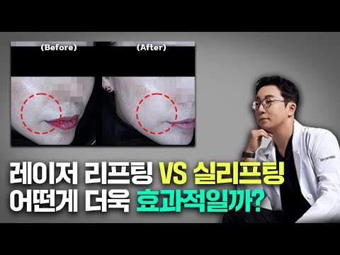 노화가 급격히 진행되는 50~60대 중년층에게 가장 효과적인 리프팅은??