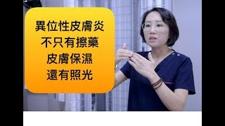 異位性皮膚炎治療除了擦藥膏、吃類固醇，有沒有其他的治療方式？