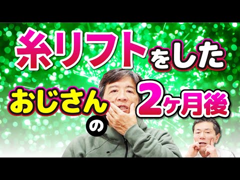 【おじさんだって綺麗になりたい！】糸リフトをしたおじさんの2ヶ月後！若返ったと言われて嬉しいおじさんたち！ #糸リフト #永江一石