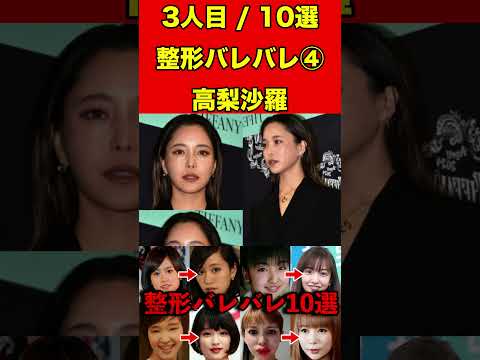 高梨沙羅④整形がバレバレな芸能人！10選 #芸能界の闇 #ゴシップ #整形 #芸能人 #噂話 #有名人  #雑学 #モデル #芸能 #女優 #アイドル #美容