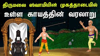 திருமலை ஸ்வாமியின் முகத்தாடையில் உள்ள காயத்தின் வரலாறு | Tirumala ananthalwar history in tamil