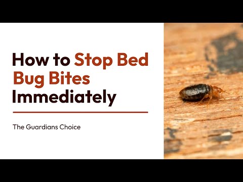 4 Ways to Stop Bed Bug Bites Immediately | How to Stop Bed Bug Bites Immediately