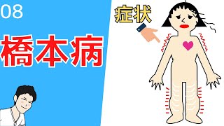 ⑧甲状腺機能低下症　どんな症状が起きるか？考え方はコチラ【看護師　薬剤師向け】