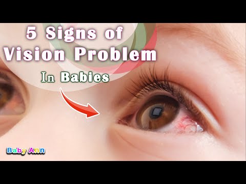 5 Signs of Vision Problem in Babies | Common Eye Problems in Babies | Common Eye Problems in Babies