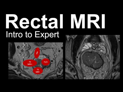 Rectal MRI: Intro to Expert, Rectal Cancer Staging