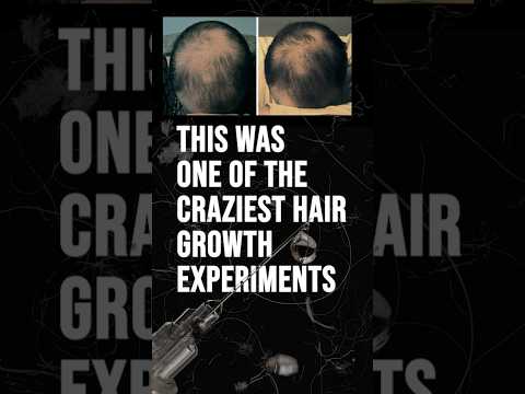 Incredible Hair Growth Experiment!