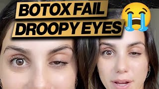 Botox Gone Wrong: Droopy Eye + Cheap Fix