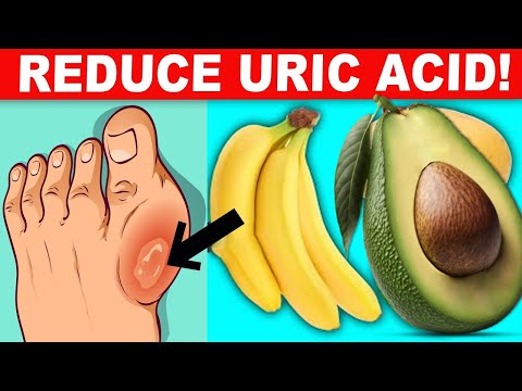 8 Foods to Lower Uric Acid and Protect Your Kidneys