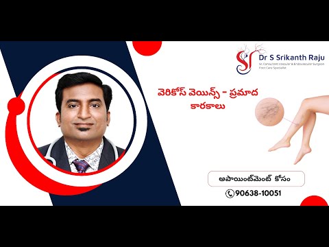 వెరికోస్ వెయిన్స్ | డా.ఎస్.శ్రీకాంత్ రాజు | వాస్కులర్ సర్జన్ | హైదరాబాద్