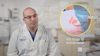 HIFU Treatment for Prostate Cancer | Dr. Ahmed Aly Hussein