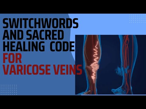 SWITCHWORDS and SACRED CODES for  Varicose Veins