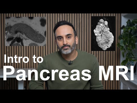 Introduction to Pancreas MRI: Approach, Pearls, Case-Based Course