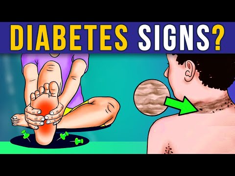 Crucial Alerts: 7 Diabetic Symptoms You MUST Recognize ASAP