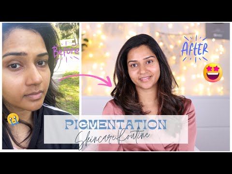 How I Controlled the Pigmentation around my mouth| Causes, Skincare, Treatment | Femirelle