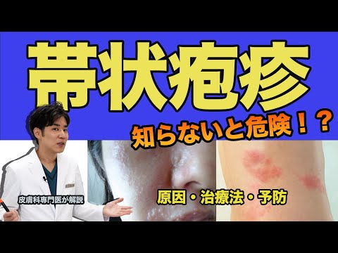 帯状疱疹の謎に迫る！原因から治療法まで徹底解説！