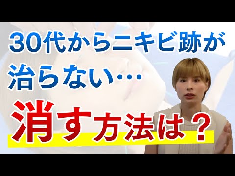 【Q&A回答】30代からニキビ跡が治らない。消す方法は？