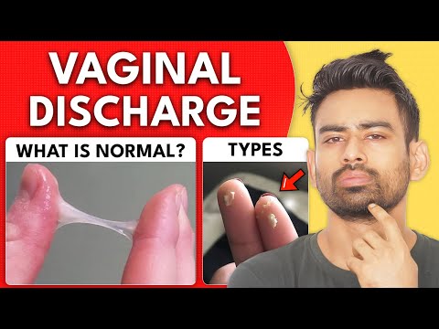 White Discharge - What's Normal & What is Not?