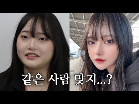 얼굴 5군데 성형 💥 딴 사람 돼서 돌아왔어요 🤭[박서아Vlog]