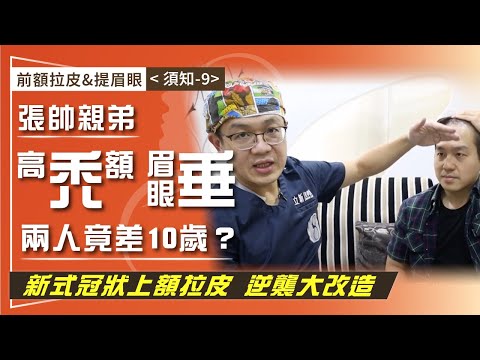 前額拉皮&提眉眼（須知-9）前額禿、眉眼下垂顯老10歲！ 張帥親弟「新式冠狀上額拉皮」逆襲改造計劃大公開