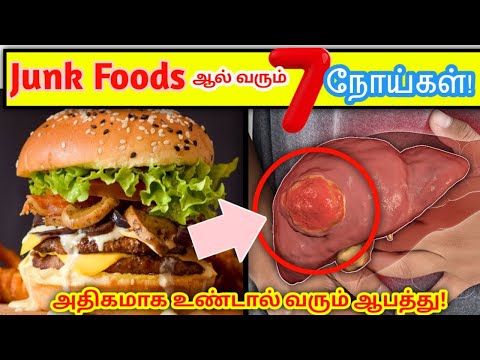 Junk foods ஆல் வரும் 07 மோசமான நோய்கள்! | 07 Most dangerous diseases caused by Junk foods