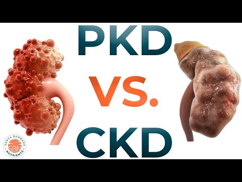 PKD vs CKD - What are the differences?