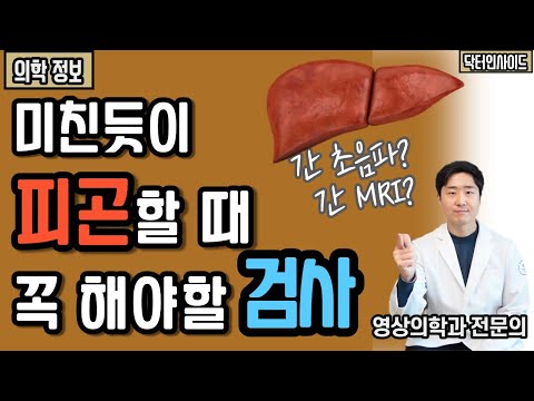 피곤하고, 힘이 없다면? 이 검사 무조건 하세요 l 간 검진 총 정리 [닥터인사이드]