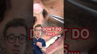 Doctor explains why you shouldn’t pluck NOSE HAIR #shorts #nosehair