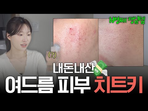 cc) 영업당해서 6통 쟁여놓고 쓰는 트러블직빵템💙+찐화장대공개ㅣ아랑