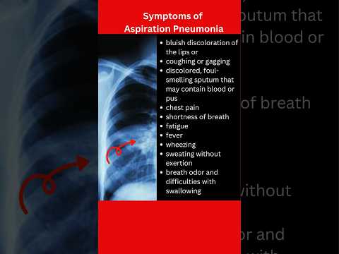 Symptoms of pneumonia #pneumoniasymptoms #pneumonia