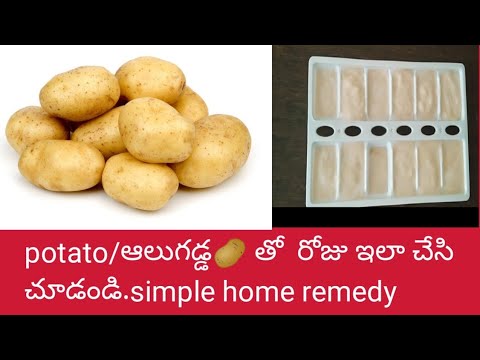 Potato ice cubes for skin//మంచు ముక్కల చిట్కా//  simple home remedy with potato 🥔