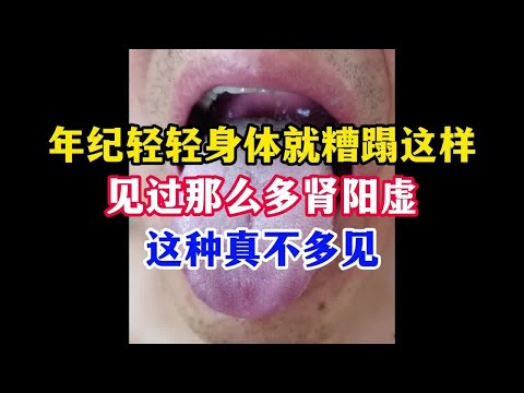 年纪轻轻身体就糟蹋这样，见过那么多肾阳虚，这种真不多见！