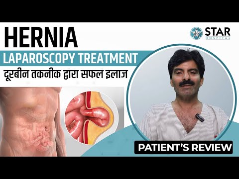 Best Hernia Hospital In Kaithal | Best Hernia Treatment Kaithal | Best Hernia Doctor Kaithal