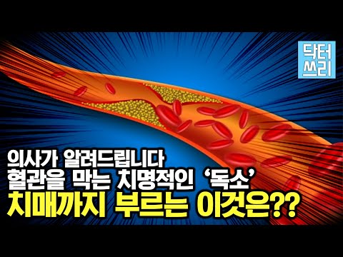 당신의 혈관을 막히게 하는 "치명적인 독소"를 제거하라 – 치매까지 부르는 이것은?