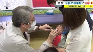 コロナ５類移行から１ヵ月　夏風邪「ヘルパンギーナ」の症状訴える子供が急増　その背景は？【香川】 (23/06/08 18:00)