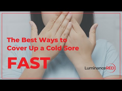 The Best Ways to Cover Up a Cold Sore Fast