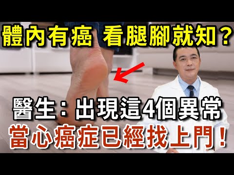 體內有癌，看腿腳就知？醫生：腿腳若出現這4個異常，警惕是癌症信號！【有書說】#中老年心語 #養生#幸福人生#深夜讀書