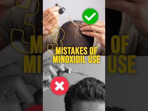 Minoxidil Biggest Mistakes - Don’t Do It Please! #minoxidil