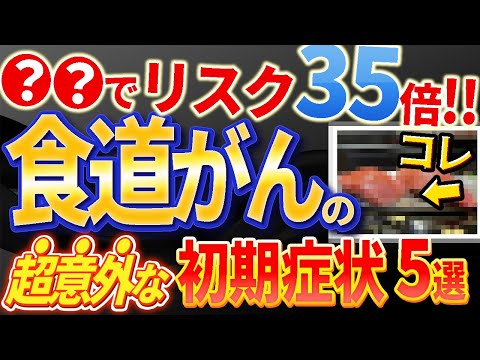 【超大切!!】絶対見逃してはいけない食道がんの初期症状やリスクについて医師が解説します。