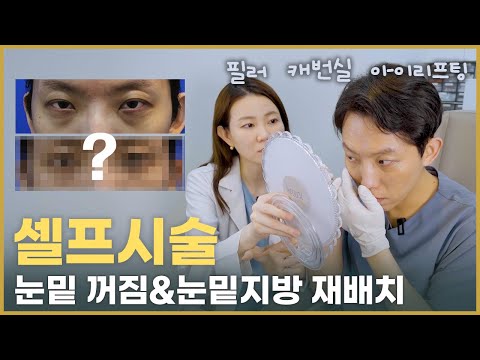 40대 눈밑지방재배치& 눈밑 꺼짐 피부과 셀프시술 결과는?! (ft. 필러, 캐번실, 아이리프팅 매선침)