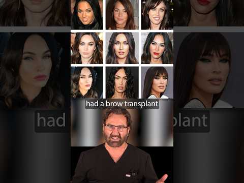 Megan Fox New Look | Plastic Surgeon Reacts