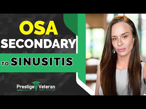 OSA Secondary to Sinusitis in VA Disability  | All You Need To Know