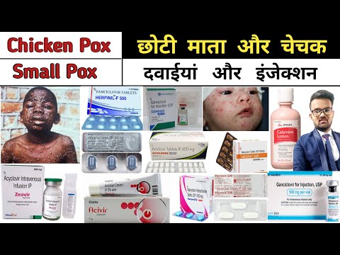 Chiken Pox | Small Pox | Antiviral Medicine | Pharmacy | B pharmacy | D pharmacy | Treatment | दवाई