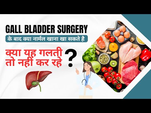 Can we eat Normal Food after Gall Bladder Surgery | Gall Bladder surgery ke baad kya khana chiye