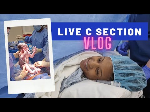 C SECTION BIRTH STORY VLOG | LIVE C SECTION VLOG | C SECTION DELIVERY 2021