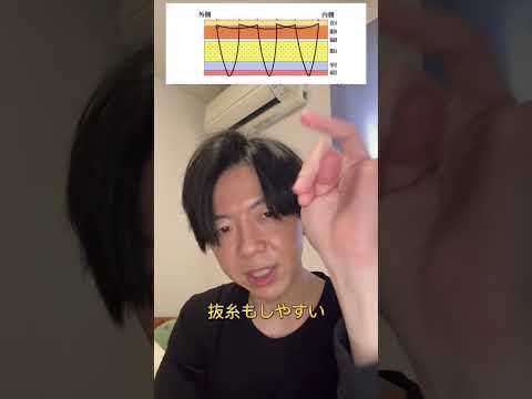 #最強の埋没法 #取れにくい埋没法#腫れにくい埋没法#修正しやすい埋没法