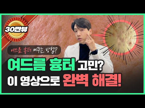 여드름 패인 흉터도 없앨 수 있을까?｜의사가 다 알려줍니다!