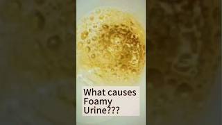 Causes of Foamy Urine #urine_infection  #Foamy #urinaryinfection  #urinaryhealth