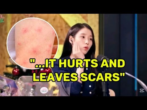 IU Opens Up About Struggling with Skeeter Syndrome